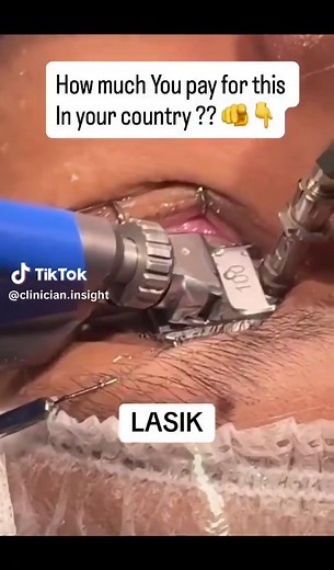 LASEK Eye Procedure: Safe Vision Correction Method
