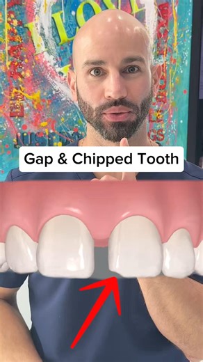 Do I get Invisalign before or after I fix my chipped tooth? ￼