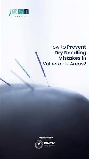 Can You REALLY Stay Safe with Dry Needling in High-Risk Areas? #acupuncture #dryneedling