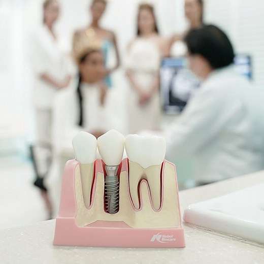 Dental Implant Fees - Implant Crown, Bridges, Dentures Promotions