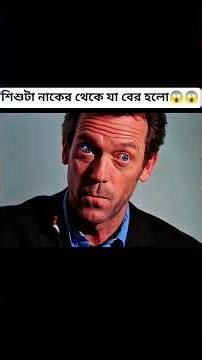 শিশুটা নাকের থেকে যা বের হলো😱😱 #facts #movie #drama