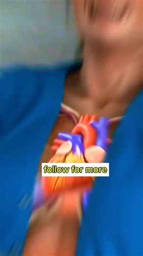 Understanding What Happens Before a Heart Attack