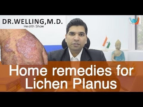 Simple Home Remedies To Get Rid Of Lichen Planus