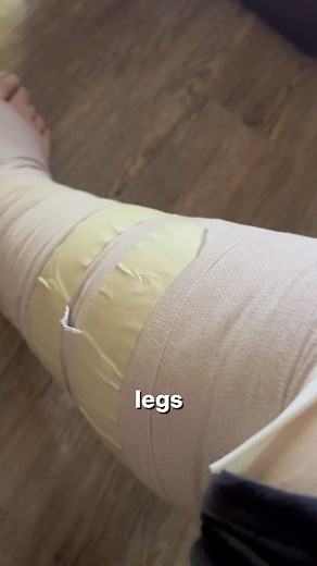 561K views · 16K reactions | My legs haven’t been this small in a long time, the lymphedema can be crazy  #weightlossjourney #fat #weightloss #fatloss #lymphedema #fblifestyle | Ethan Benard | Facebook