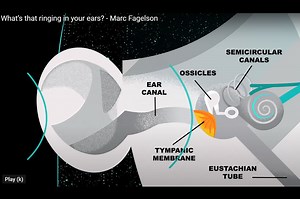 TED-Ed Animation Shows What Tinnitus Sounds Like