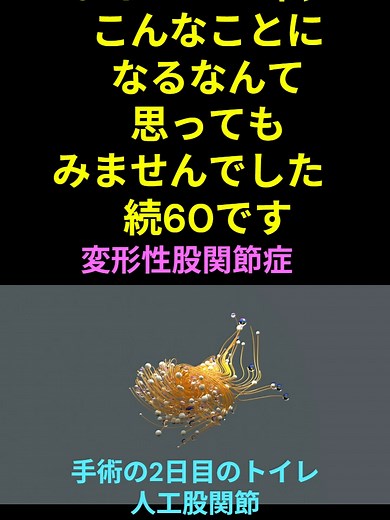 突然の原因不明の足の痛み61【誰にでも起こりうる病気】 【人工股関節手術後のトイレ】#変形性股関節症 #最後まで見て #手術後 #人工股関節 #入院生活 @lapiscrearth