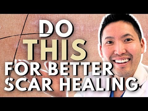 How To Treat Scars Like a Dermatologist