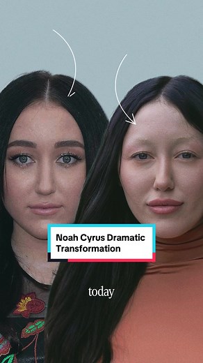 Noah Cyrus' Dramatic Face Transformation Explained