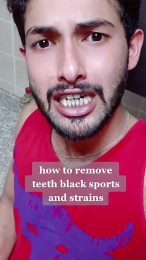 Effective Home Remedies for Removing Teeth Black Spots and Stains