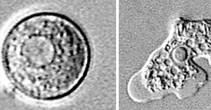 Parasite called Naegleria fowleri has been found in several states and is blamed for 3 deaths in the U.S. this year