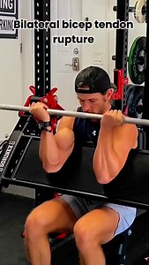*Bicep Tendon Rupture: A Hidden Danger in Pre-Chair Exercises* A bicep tendon rupture can occur during the deceleration phase of pre-chair exercises, especially when: *Overloading occurs*: Decelerating with too much weight can exceed your eccentric strength capacity, putting excessive stress on the bicep tendon. *Inadequate warm-up*: Insufficient warming up can leave your muscles and tendons vulnerable to injury. *Weak shoulder stabilizers*: Poor shoulder stability can lead to a protracted shoul