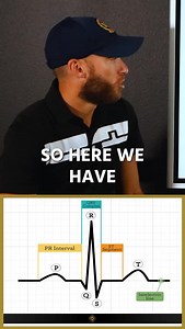 3.6K views · 6.6K reactions | Breaking down the ECG for you! #ecg #paramedic #emts #paramedicschool | The Paramedic Coach | Facebook