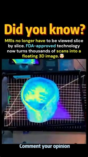 3D Scan Of Your BRAIN! 🤯🥴