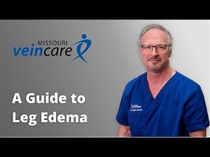 Guide to Leg Edema