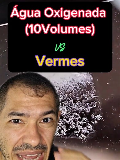 Teste da Água Oxigenada contra Vermes! ##curiosidades ##fatoscuriosos ##microscopio ##aprender ##biologia