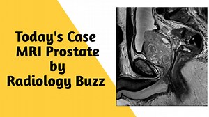 3.2K views · 32 reactions | MRI Prostate Case - What is your diagnosis? #Radiology_buzz #ProstateMRI #MedicalCaseStudy #Radiology #Urology #MedicalDiagnosis #MRIAnalysis #HealthCommunity | Radiology buzz | Facebook