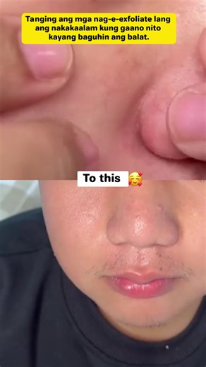 Achieve Brighter Skin with SHE Eureka Exfoliating Gel