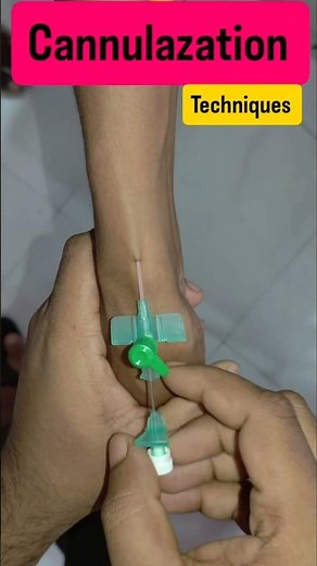IV Cannulation Technique Step by Step | Peripheral IV Cannula Insertion | Nursing Skills 2026#shorts