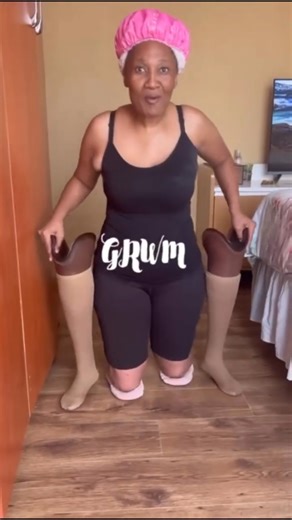 Bilateral Amputee Woman Walks Again | Inspiring Prosthetic Legs Transformation #artificiallimbs