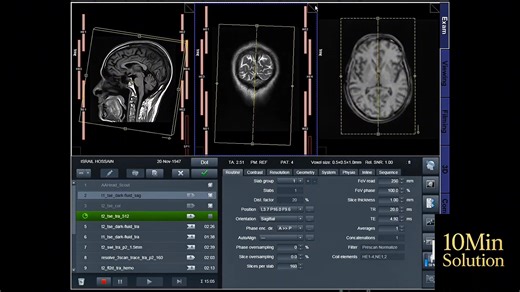37K views · 683 reactions | Step-by-Step MRI Brain Planning on SIEMENS 3T Scanner” | Muktadir Rahman | Facebook