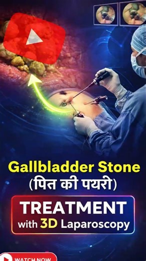 Gallbladder Stones Treatment with 3D Laparoscopy | Sahaj Hospital, Indore