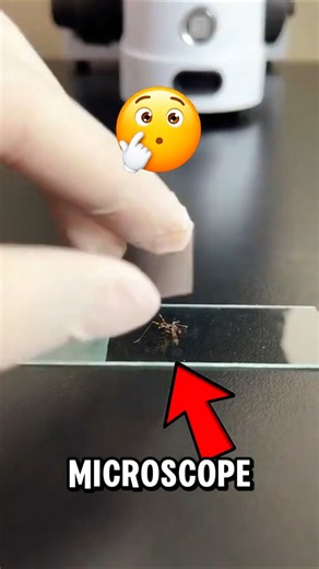 What a Mosquito Looks Like Under a Microscope Will Shock You! 🦟😱