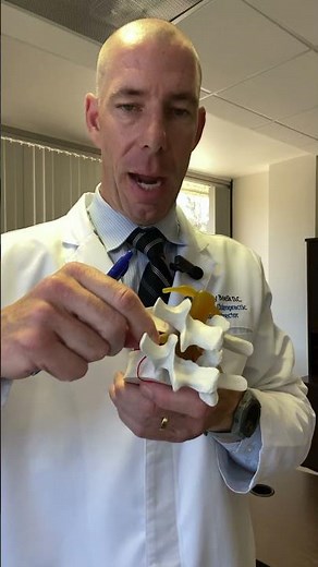 What is Foraminal Stenosis?