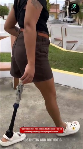 WALKING PROUD 🌸 Every step tells a story 💪 #ProstheticLegJourney