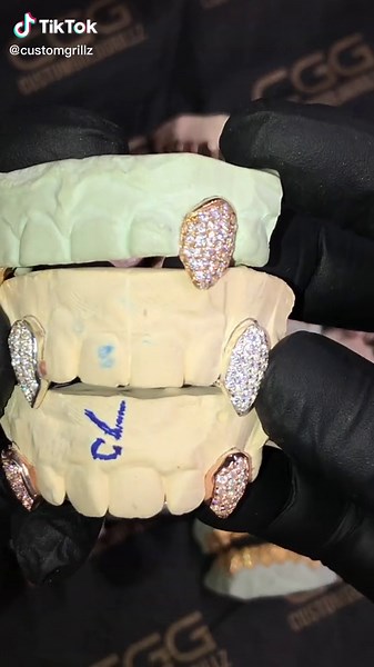 Top Custom Gold Grillz - Best Sellers