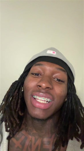 Dreadlock Truths and Misconceptions Revealed