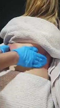 Fat freezing in action