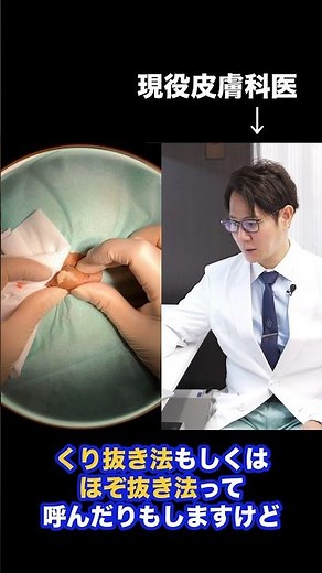 What Would He Think About This Atheroma Removal? Insights from a Japanese Dermatologist