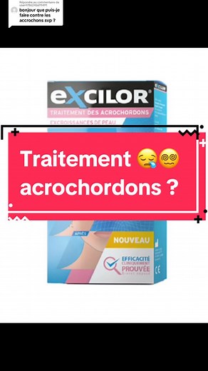 Traitement des acrochordons avec Excilor