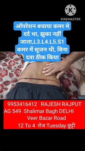 . सायटिका का दर्द L4. L5. S1 कमर से पेर तक दर्द जा रहा है कुल्ला से पेर तक दर्द जा रहा है हिप से पेर तक दर्द जाता चला नहीं जाता पेर में अकड़न और जकड़न पेर की नस दब गई सुन पन हो रहा तुरंत ठीक RajeshRajput 📞Contact us:- 9953416412 Time:- 11:00 AM To 4:00 PM Open:- Monday To Sunday Important:- ( Tuesday Closed ) (अपॉइंटमेंट के लिए कॉल करे ) इन रोगों को ठीक करने का पुरी दुनिया में हिन्दुस्तान का पहला इंसान नसे दबाकर ठीक किया जाता है Treatment By Acupressure कमर दर्द सर्वाइकल स्लिप डिस्क सायाटीका घु