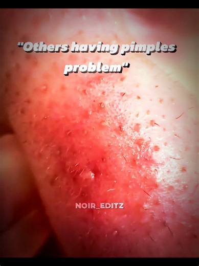 Want to glow up this summer?😏use this product,mag check out na kayo guys!😁🔥#fyp #learnontiktok #tiktokshop #foryou #fyppppppppppppppppppppppp