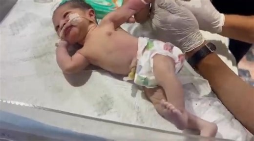 66K views · 1.3K reactions | Cute baby iv cannulation and vitamin k does step by step #baby #cutebaby #newborn #babycare #babyboy | Gautam Ashish | Facebook