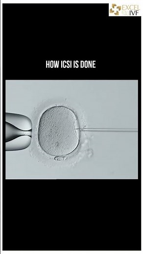 Inside the Lab: ICSI Step-By-Step | Dr Rhythm Gupta - Infertility and IVF specialist at Excel IVF