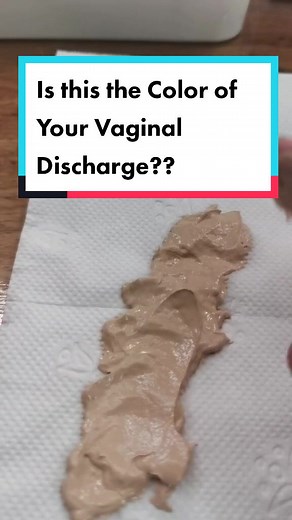 Understanding Vaginal Discharge Color: Health Tips for Women