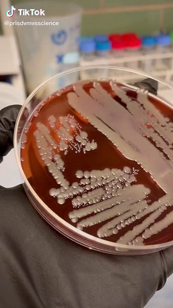 Understanding Enterococcus Faecalis: A Microbiological Exploration