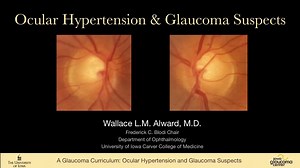 15 Ocular Hypertension and Glaucoma Suspects (OHTS) #The_University_of_Iowa_Glaucoma_Curriculum #Glaucoma http://curriculum.iowaglaucoma.org/ | Piece of ophthalmology