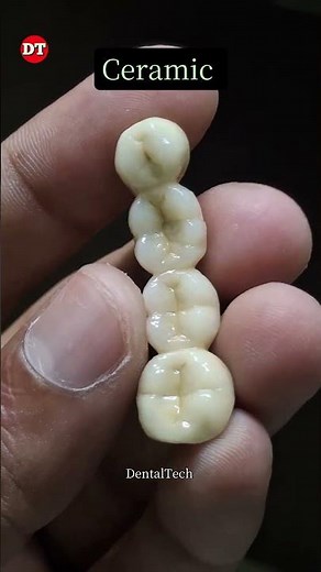 Posterior ceramic bridge|| ceramic anatomy| dental technician video| anterior| build up| porcelain