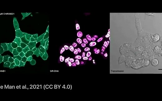 eLife：揭示细胞内信号传到的分子机制 WNT分子机制