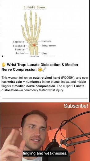 Step 1 - Lunate Bone Damage