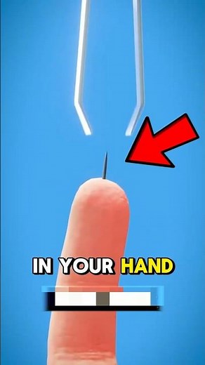 Never Use A Tweezers For A Splinter Again! 😳