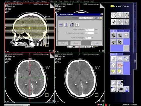 CT de cranio/multslice