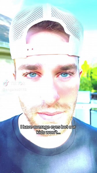 Understanding Central Heterochromia and Other Eye Colors