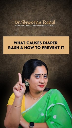 Dr Shwetha Rahul | Dermatologist on Instagram: "How to Prevent Diaper Rash – Derm Explains #diaperrashcream #diaperrash #babyskin #newmom #drshwetharahul"