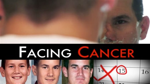 Facing Cancer (2013)