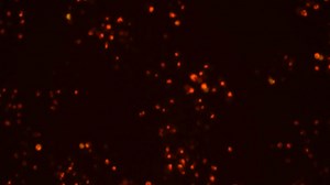 恒意赛生物细胞实验-Ad-mCherry-GFP-LC3B重组腺病毒自噬流染色~ #国自然 #细胞实验 #动物实验 #SCI #医学科研-镜泽BioTech-镜泽BioTech-哔哩哔哩视频