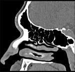 Hummer H2 Rear Shocks A-Premium Rear Shock Absorbers (Pair) For 2003-2007 Hummer H2 - KG5194 Replacement A-Premium Shock Absorbers
